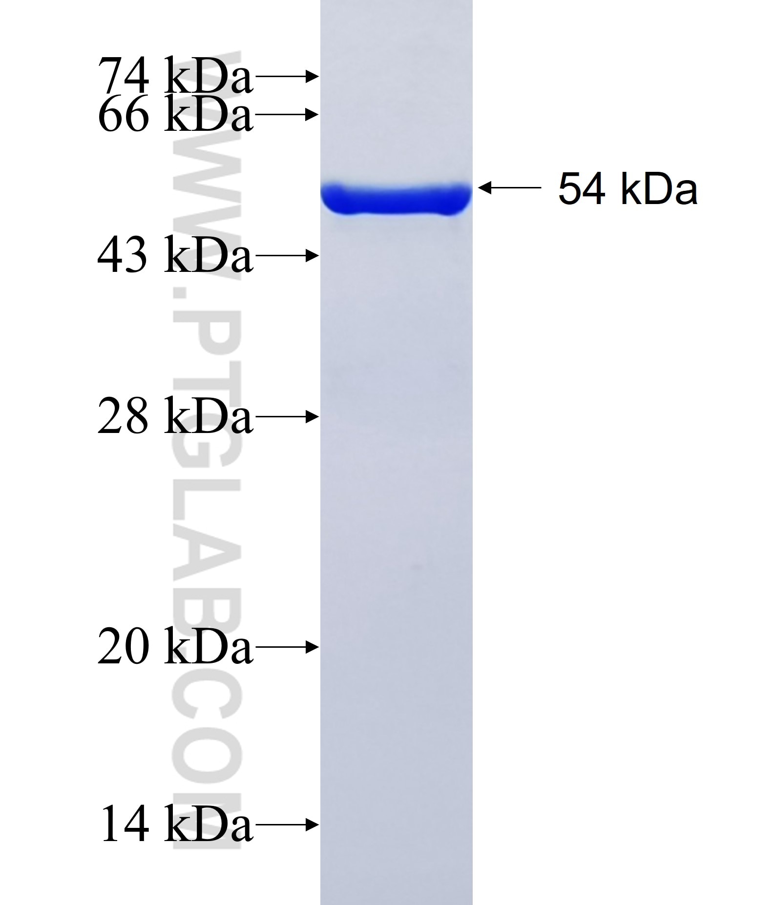 WDHD1 fusion protein Ag38697 SDS-PAGE WDHD1 fusion protein Ag38697 SDS-PAGE