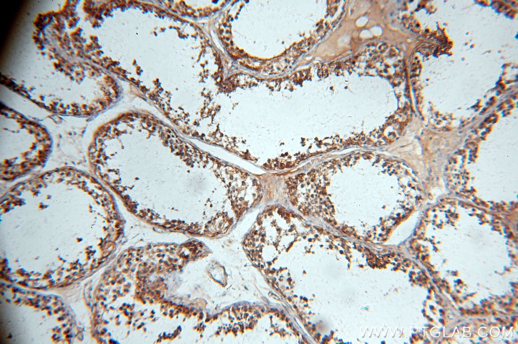 Immunohistochemistry (IHC) staining of human testis tissue using WDR1 Polyclonal antibody (13676-1-AP)