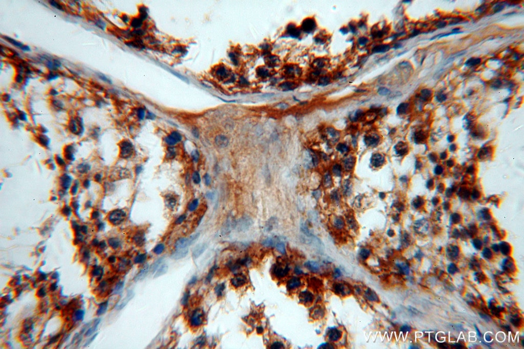 Immunohistochemistry (IHC) staining of human testis tissue using WDR1 Polyclonal antibody (13676-1-AP)