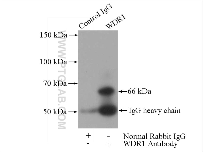 Immunoprecipitation (IP) experiment of mouse skeletal muscle tissue using WDR1 Polyclonal antibody (13676-1-AP)