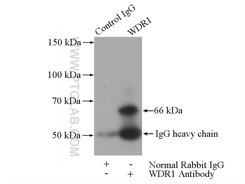 IP experiment of mouse skeletal muscle using 13676-1-AP