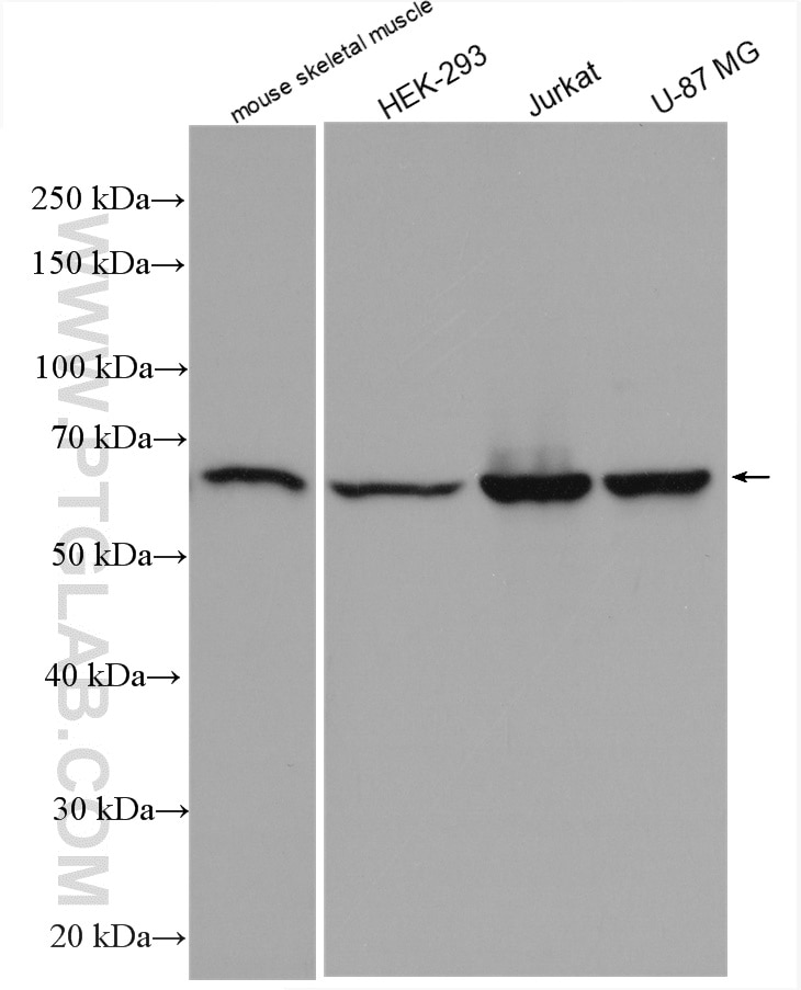 Western Blot (WB) analysis of various lysates using WDR1 Polyclonal antibody (13676-1-AP)