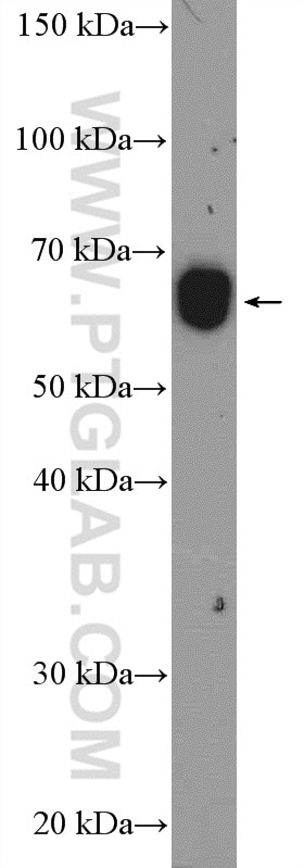 Western Blot (WB) analysis of rat skeletal muscle tissue using WDR1 Polyclonal antibody (13676-1-AP)
