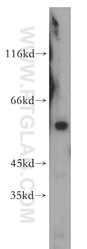 Western Blot (WB) analysis of Jurkat cells using WDR13 Polyclonal antibody (20122-1-AP)