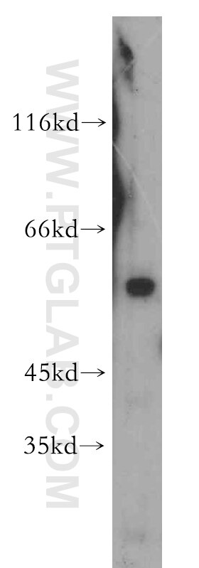WB analysis of Jurkat using 20122-1-AP