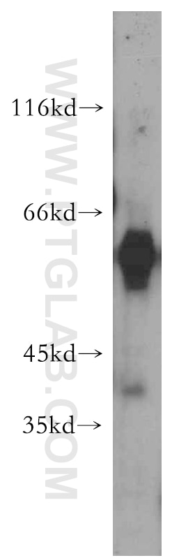 Western Blot (WB) analysis of human heart tissue using WDR13 Polyclonal antibody (20122-1-AP)