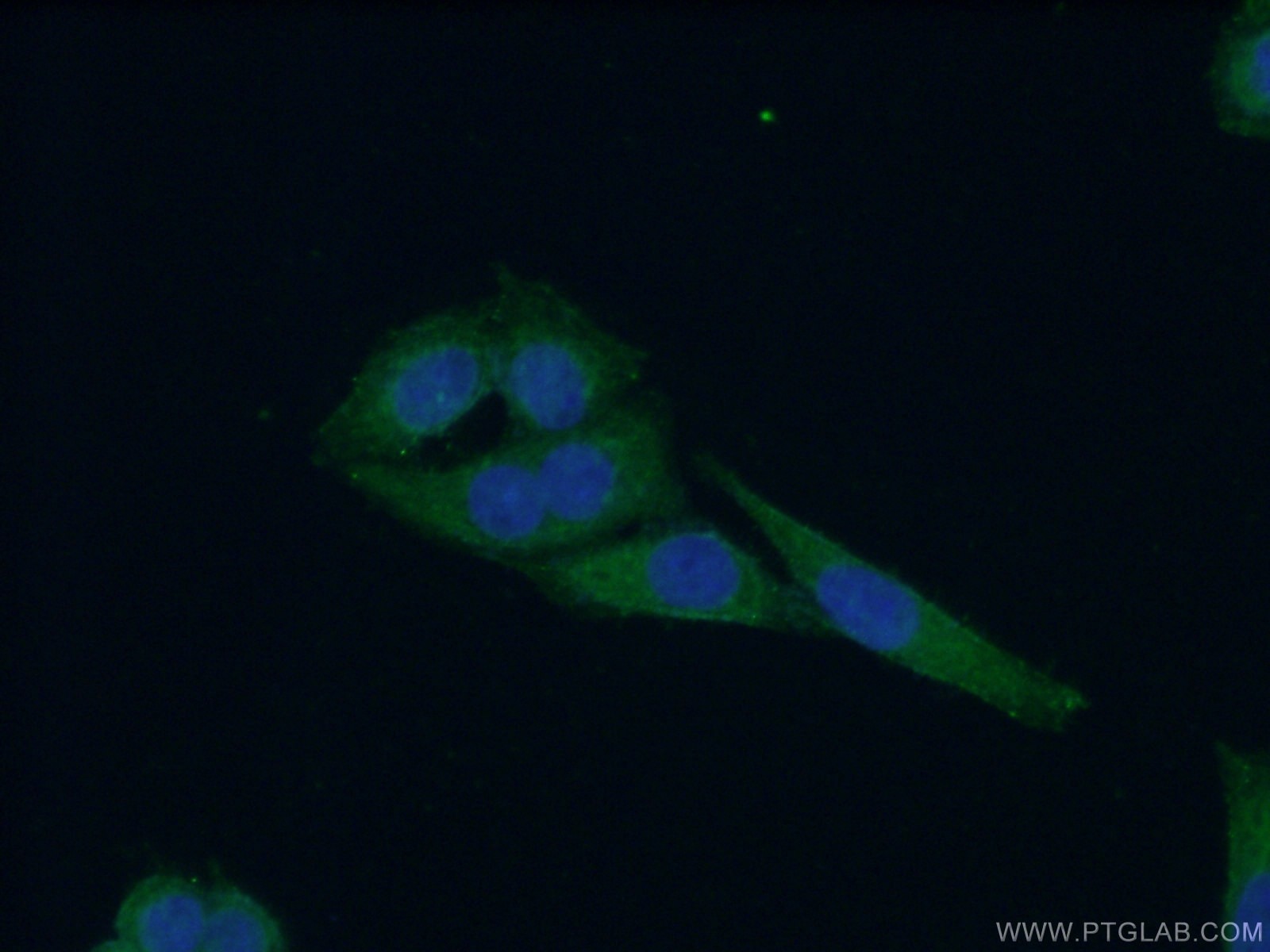 Immunofluorescence (IF) / fluorescent staining of HeLa cells using WDR16 Polyclonal antibody (12644-1-AP)