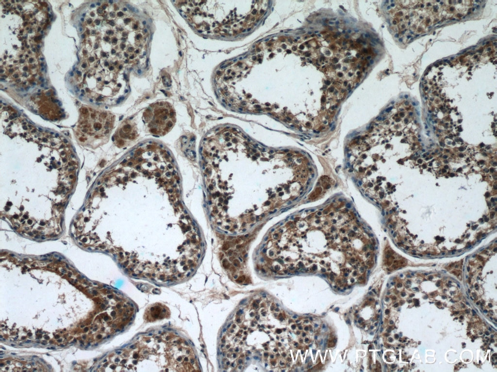 Immunohistochemistry (IHC) staining of human testis tissue using WDR16 Polyclonal antibody (12644-1-AP)