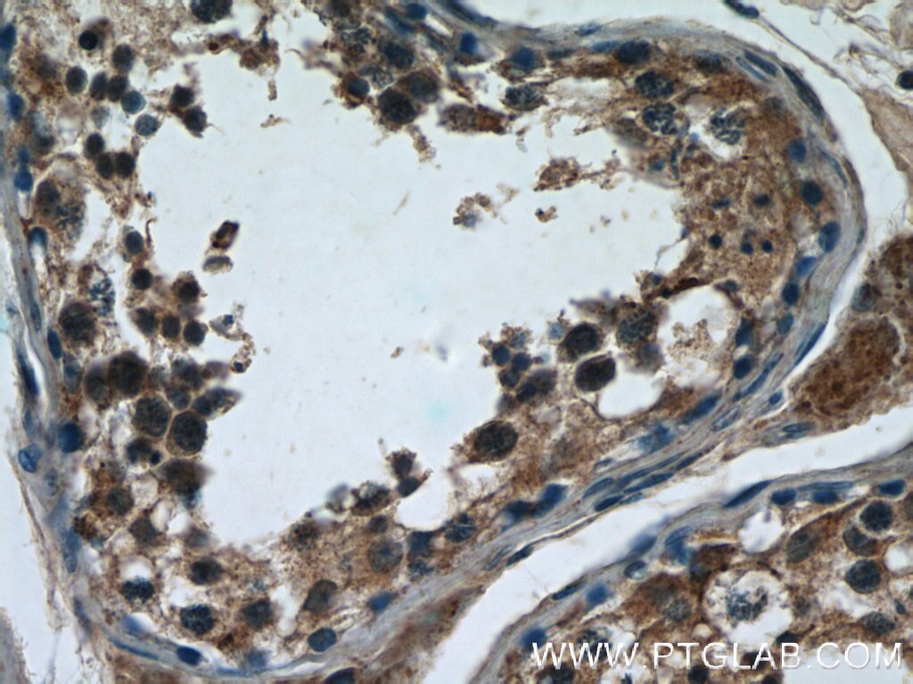 Immunohistochemistry (IHC) staining of human testis tissue using WDR16 Polyclonal antibody (12644-1-AP)