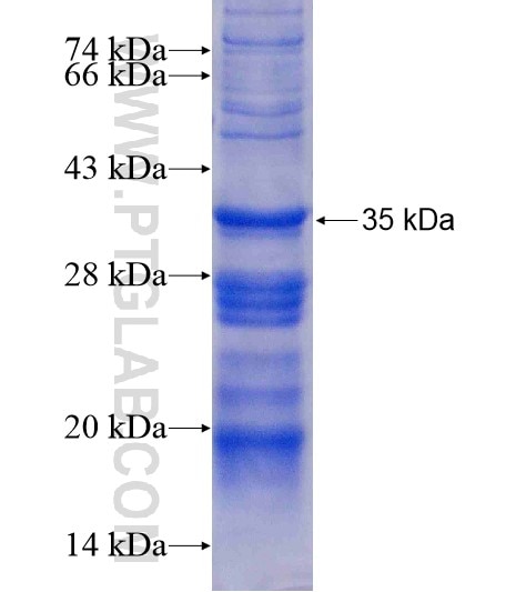 WDR16 fusion protein Ag22166 SDS-PAGE