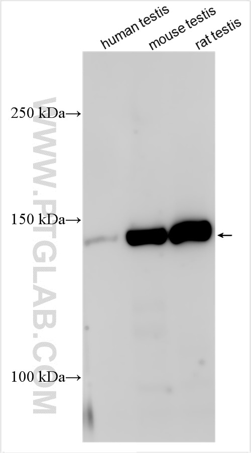 Western Blot (WB) analysis of various lysates using WDR17 Polyclonal antibody (32315-1-AP)