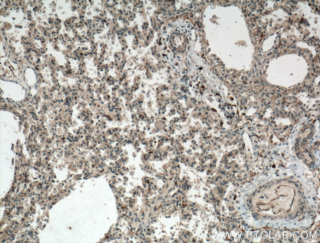 Immunohistochemistry (IHC) staining of human lung tissue using WDR18 Polyclonal antibody (15165-1-AP)