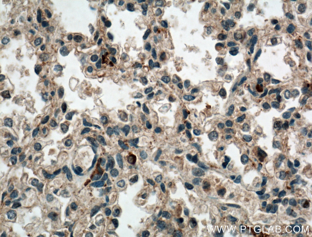 Immunohistochemistry (IHC) staining of human lung tissue using WDR18 Polyclonal antibody (15165-1-AP)