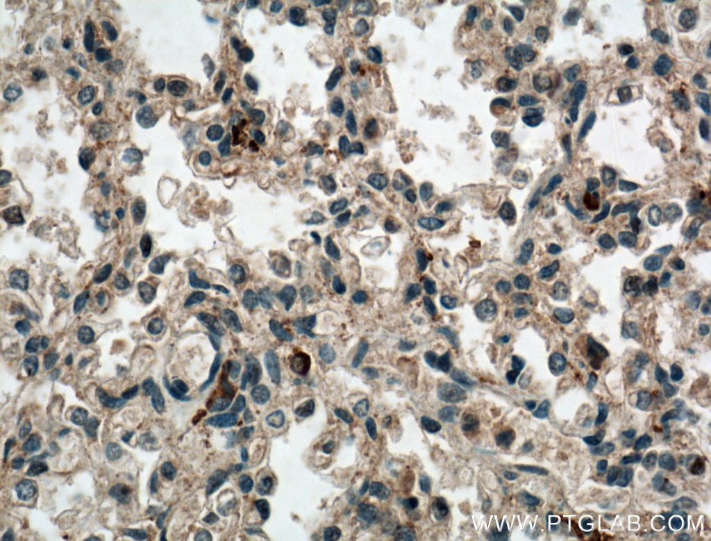 IHC staining of human lung using 15165-1-AP