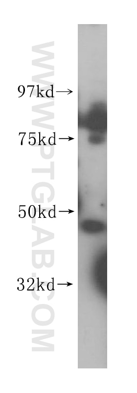 Western Blot (WB) analysis of Jurkat cells using WDR18 Polyclonal antibody (15165-1-AP)