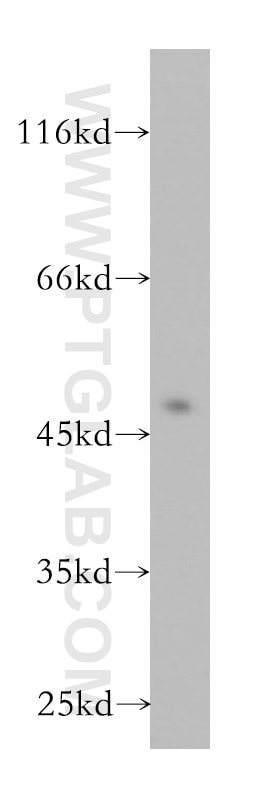 Western Blot (WB) analysis of Jurkat cells using WDR18 Polyclonal antibody (15165-1-AP)