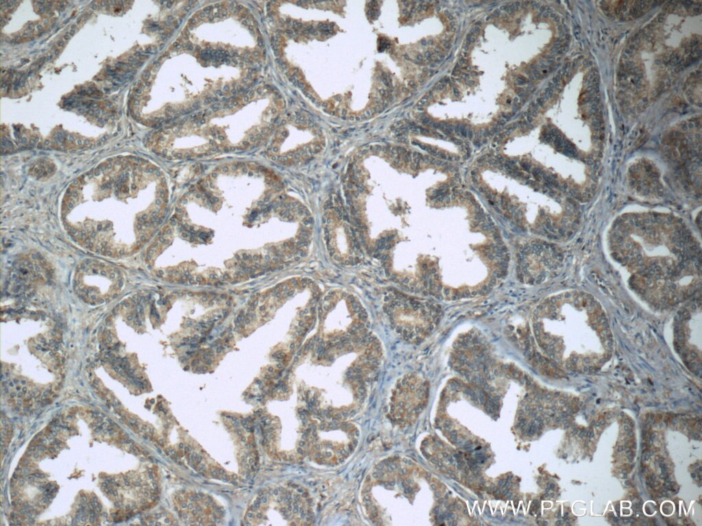 Immunohistochemistry (IHC) staining of human prostate hyperplasia tissue using WDR19/IFT144 Polyclonal antibody (13647-1-AP)
