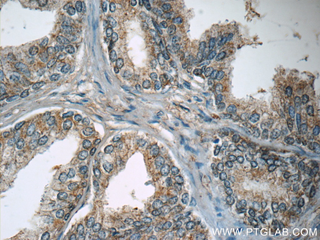 Immunohistochemistry (IHC) staining of human prostate hyperplasia tissue using WDR19/IFT144 Polyclonal antibody (13647-1-AP)