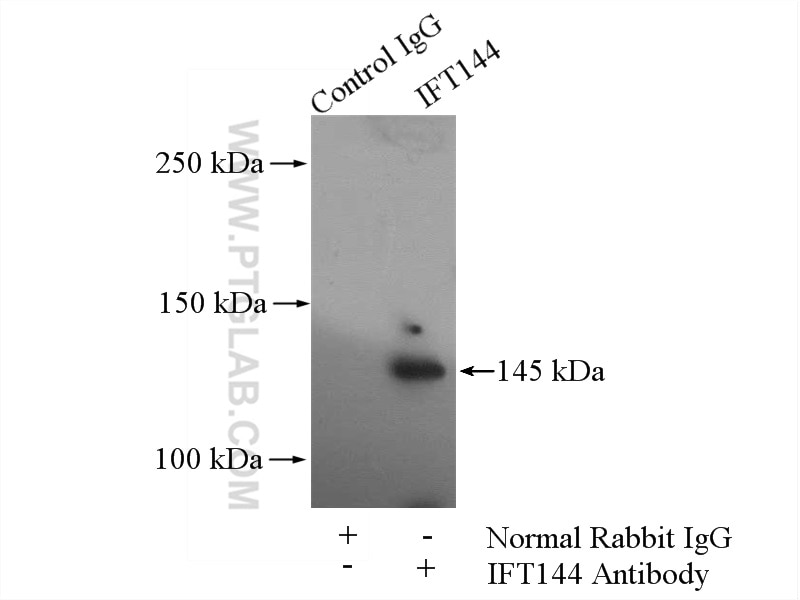 Immunoprecipitation (IP) experiment of HEK-293 cells using WDR19/IFT144 Polyclonal antibody (13647-1-AP)