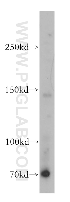 Western Blot (WB) analysis of HEK-293 cells using WDR19/IFT144 Polyclonal antibody (13647-1-AP)