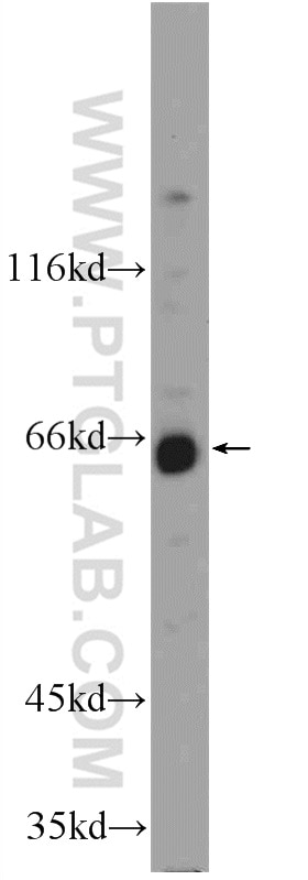 Western Blot (WB) analysis of HeLa cells using WDR20 Polyclonal antibody (25164-1-AP)