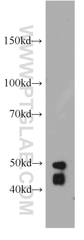 WB analysis of MCF-7 using 21571-1-AP