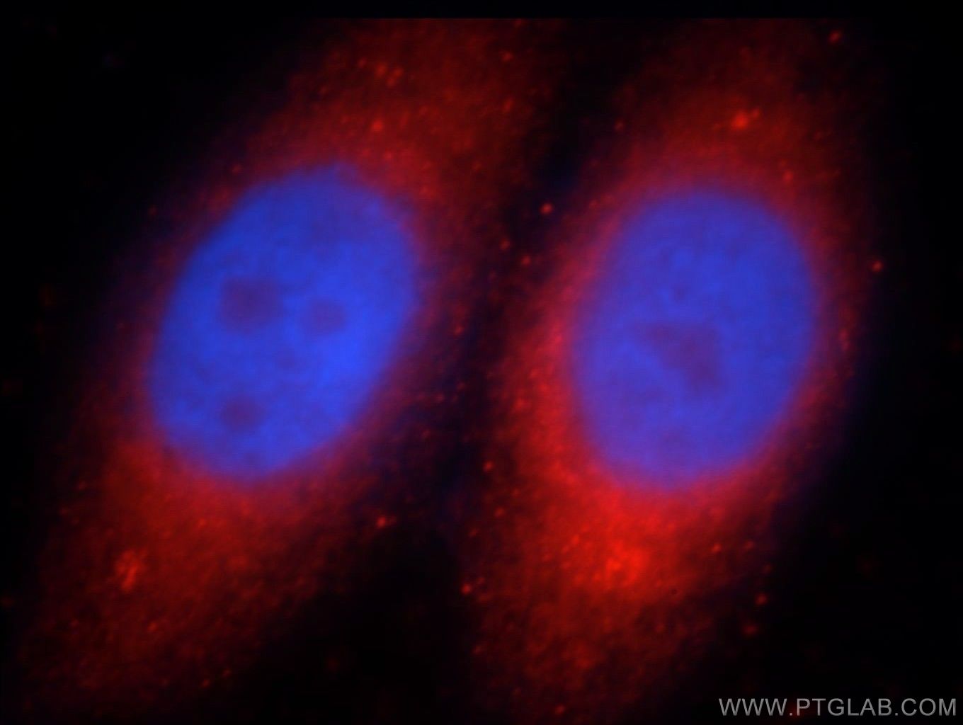 IF Staining of HepG2 using 20778-1-AP