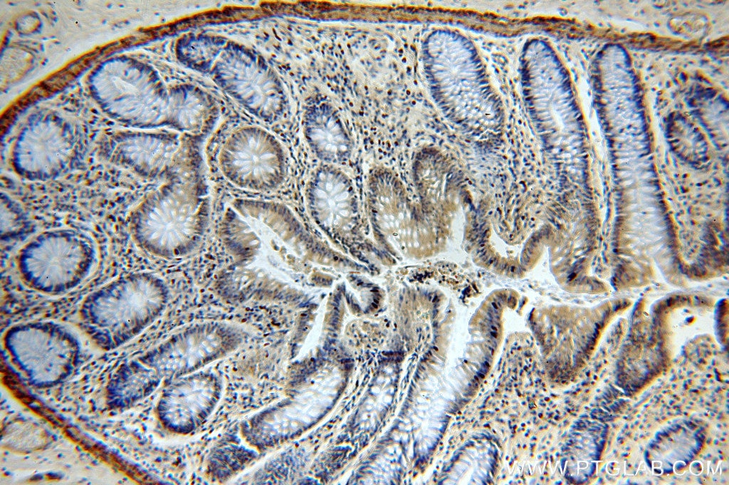 Immunohistochemistry (IHC) staining of human colon tissue using WDR24 Polyclonal antibody (20778-1-AP)