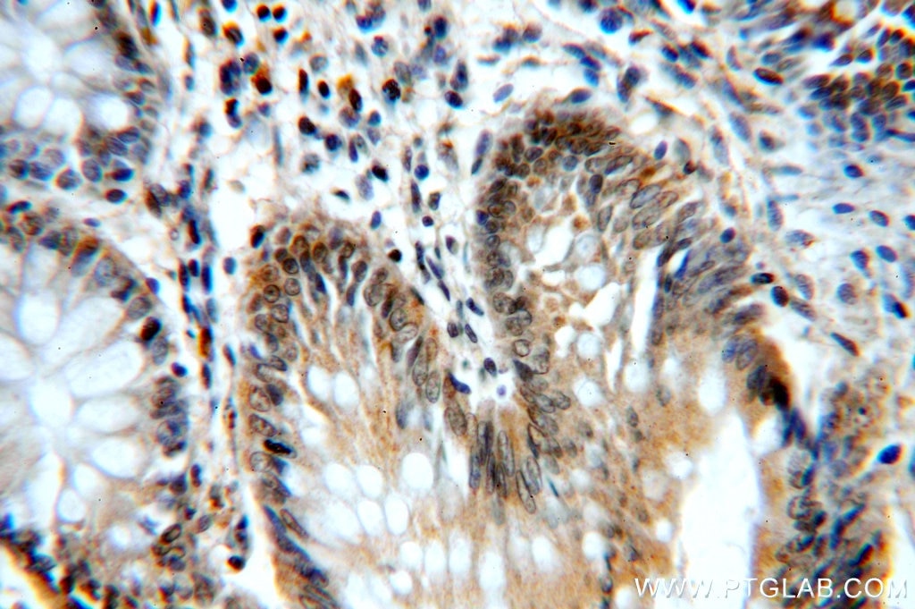 Immunohistochemistry (IHC) staining of human colon tissue using WDR24 Polyclonal antibody (20778-1-AP)