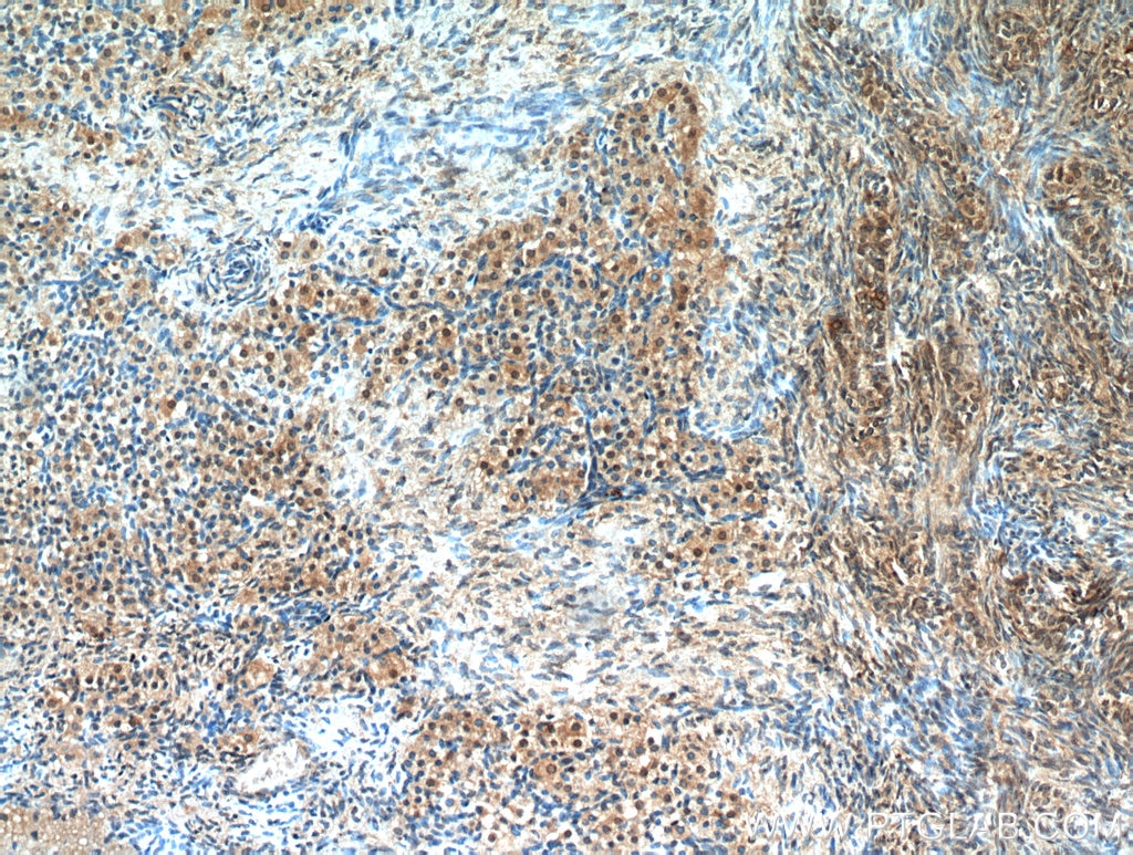 Immunohistochemistry (IHC) staining of human ovary tissue using WDR24 Polyclonal antibody (20778-1-AP)