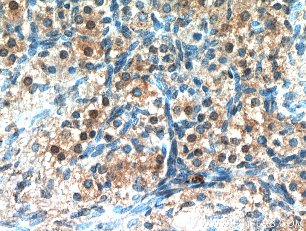 Immunohistochemistry (IHC) staining of human ovary tissue using WDR24 Polyclonal antibody (20778-1-AP)