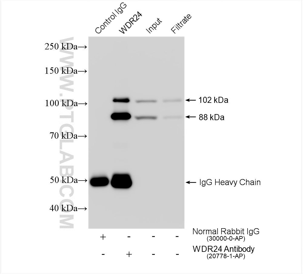 Immunoprecipitation (IP) experiment of HeLa cells using WDR24 Polyclonal antibody (20778-1-AP)