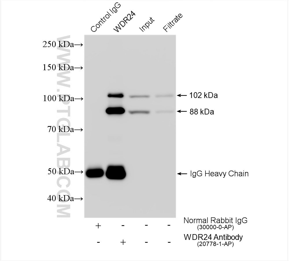 IP experiment of HeLa using 20778-1-AP