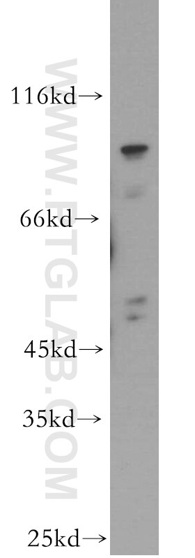 WDR24 Polyclonal antibody