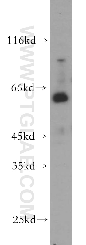 Western Blot (WB) analysis of mouse brain tissue using WDR24 Polyclonal antibody (20778-1-AP)