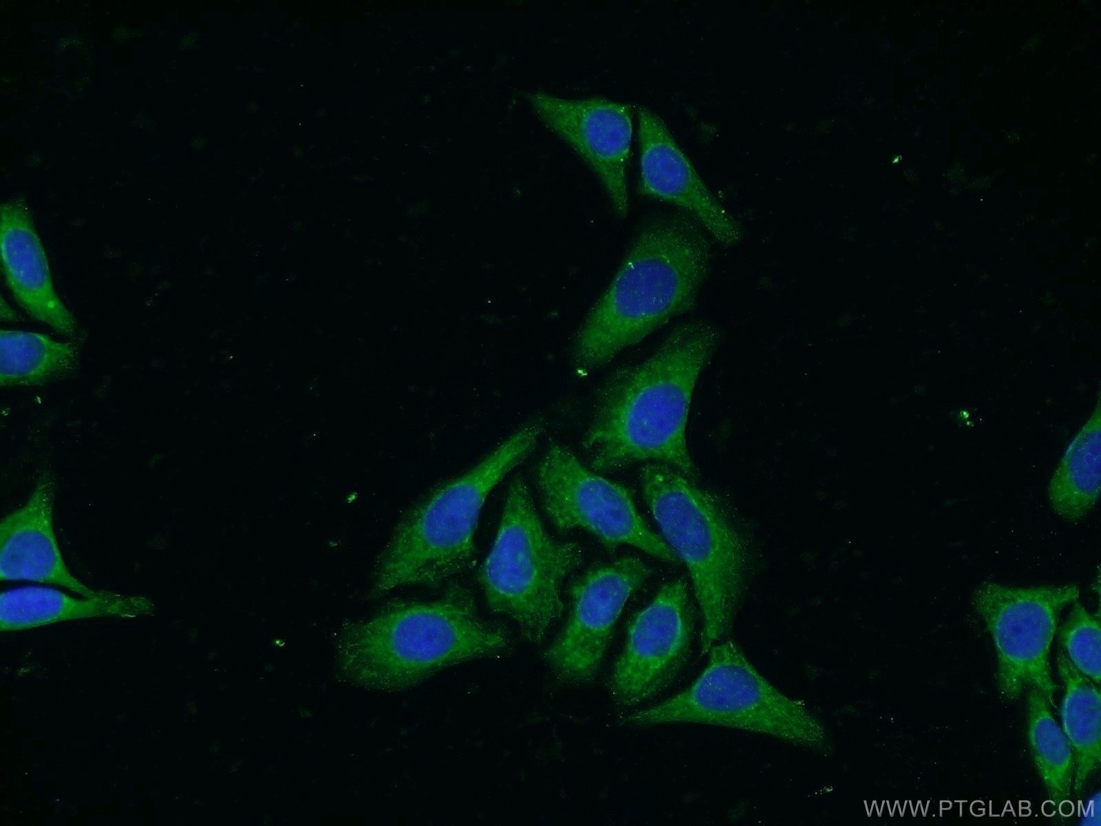 Immunofluorescence (IF) / fluorescent staining of HepG2 cells using WDR32 Polyclonal antibody (20483-1-AP)