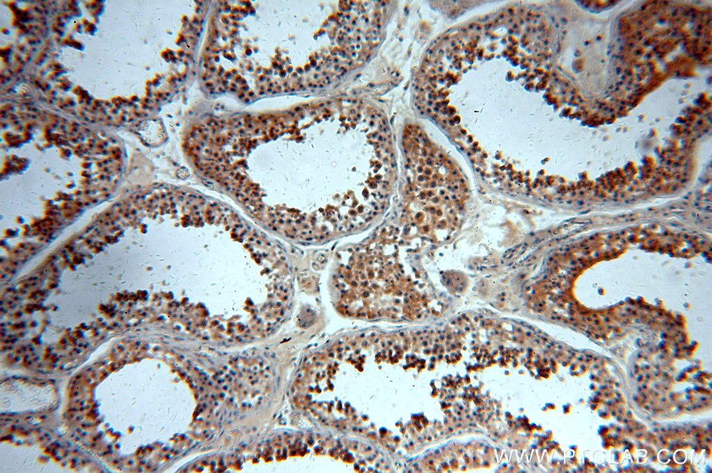 Immunohistochemistry (IHC) staining of human testis tissue using WDR32 Polyclonal antibody (20483-1-AP)