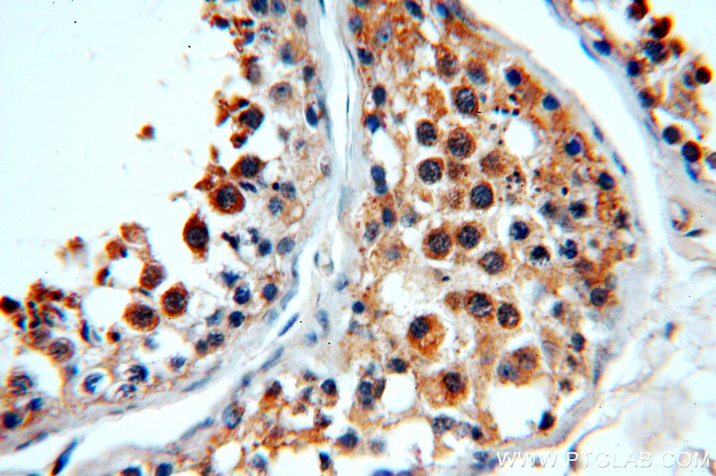 Immunohistochemistry (IHC) staining of human testis tissue using WDR32 Polyclonal antibody (20483-1-AP)