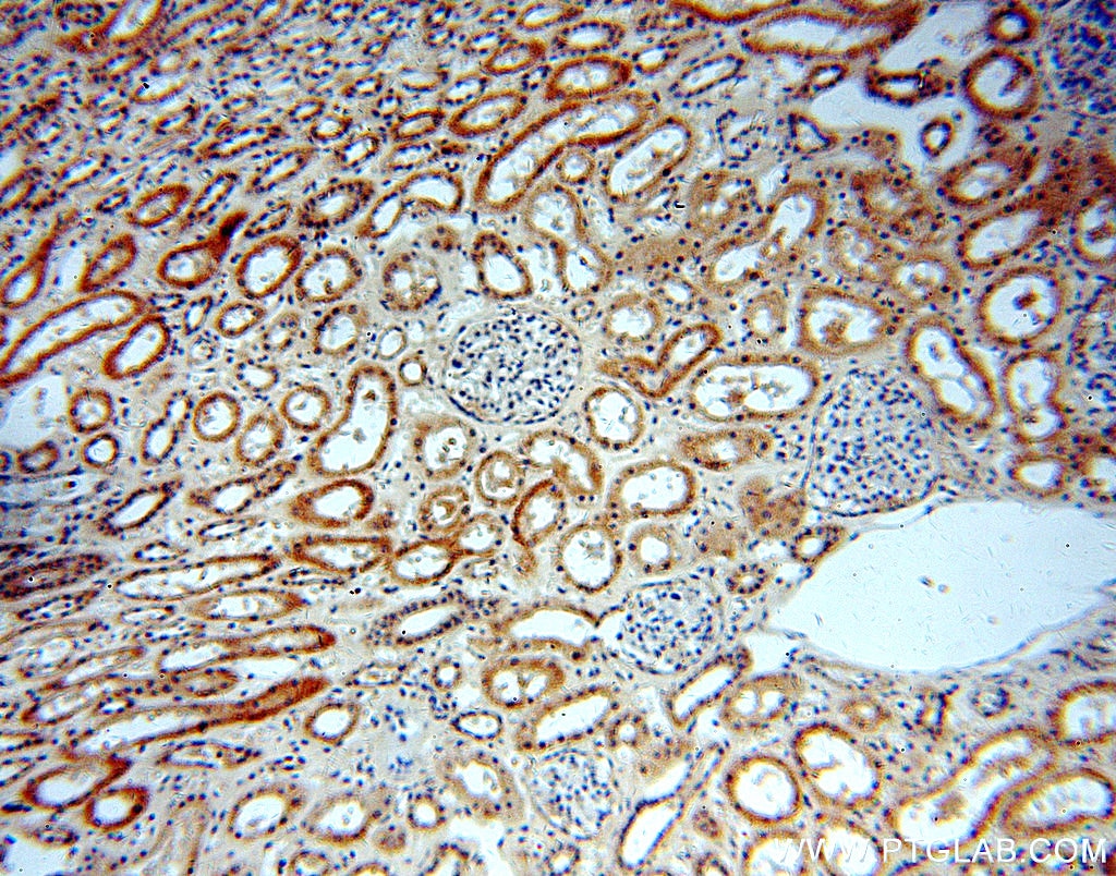 Immunohistochemistry (IHC) staining of human kidney tissue using WDR32 Polyclonal antibody (20483-1-AP)