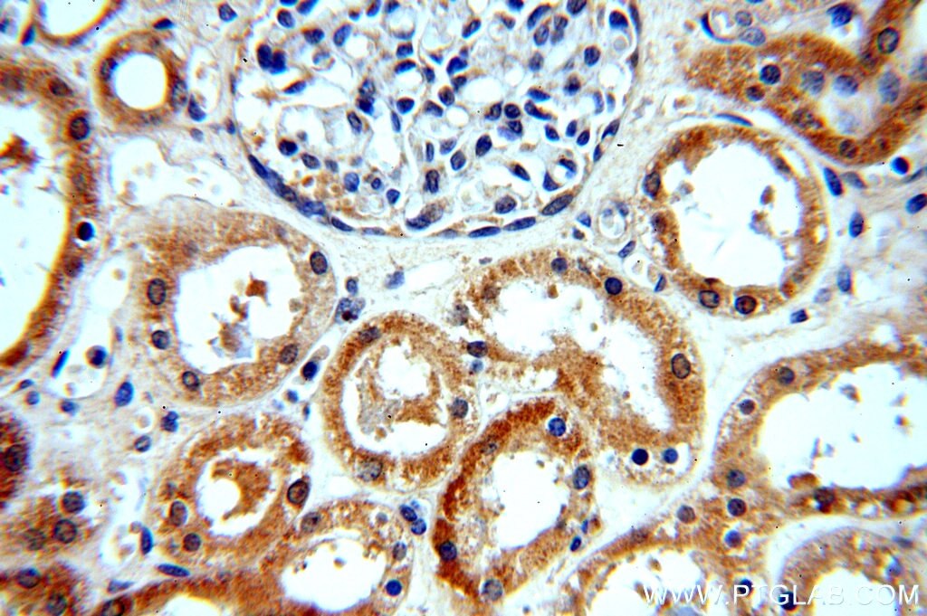 Immunohistochemistry (IHC) staining of human kidney tissue using WDR32 Polyclonal antibody (20483-1-AP)