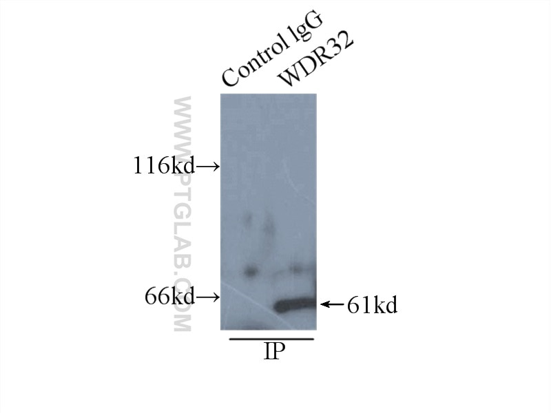 Immunoprecipitation (IP) experiment of HepG2 cells using WDR32 Polyclonal antibody (20483-1-AP)