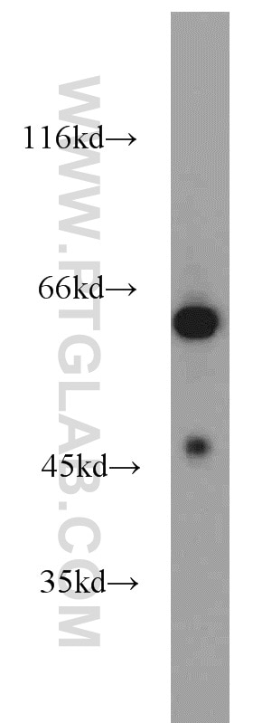 Western Blot (WB) analysis of HepG2 cells using WDR32 Polyclonal antibody (20483-1-AP)