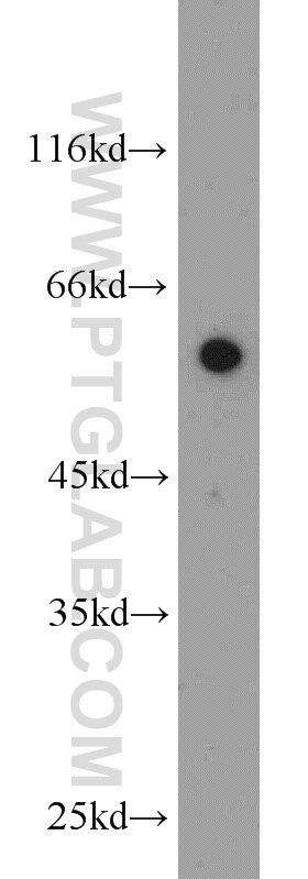 Western Blot (WB) analysis of HeLa cells using WDR32 Polyclonal antibody (20483-1-AP)