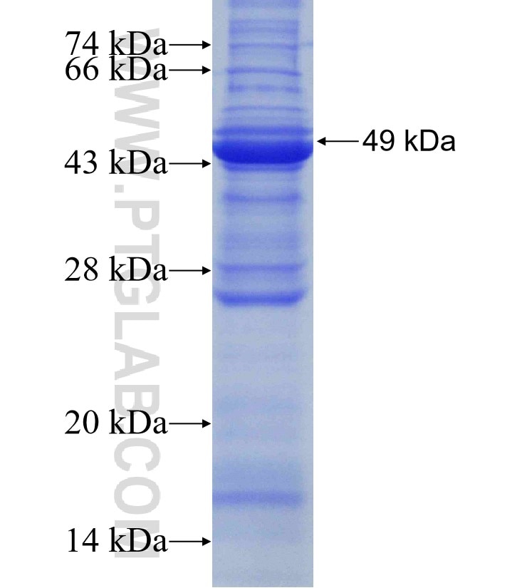 WDR32 fusion protein Ag14360 SDS-PAGE