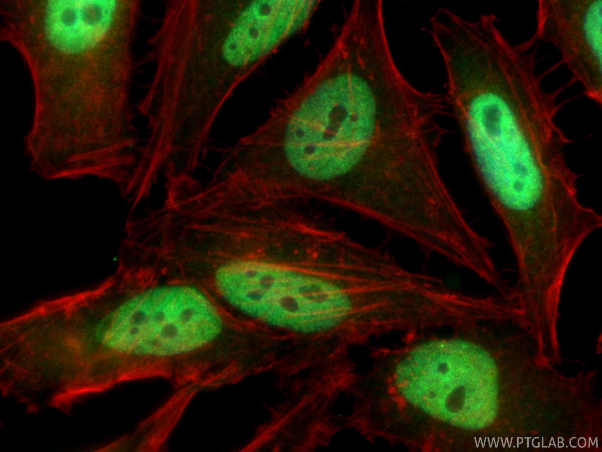 IF Staining of HeLa using 22614-1-AP Immunofluorescence (IF) / fluorescent staining of HeLa cells using WDR33 Polyclonal antibody (22614-1-AP)