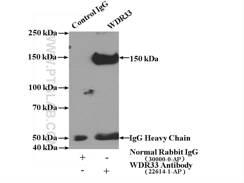 Immunoprecipitation (IP) experiment of HeLa cells using WDR33 Polyclonal antibody (22614-1-AP)