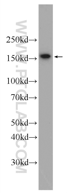 Western Blot (WB) analysis of HepG2 cells using WDR33 Polyclonal antibody (22614-1-AP)