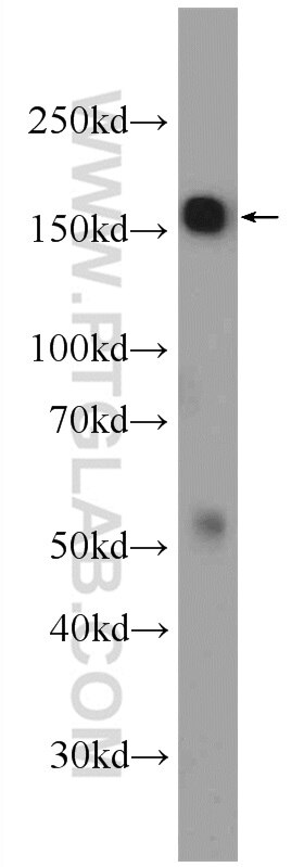 Western Blot (WB) analysis of HeLa cells using WDR33 Polyclonal antibody (22614-1-AP)