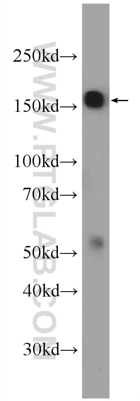 WB analysis of HeLa using 22614-1-AP