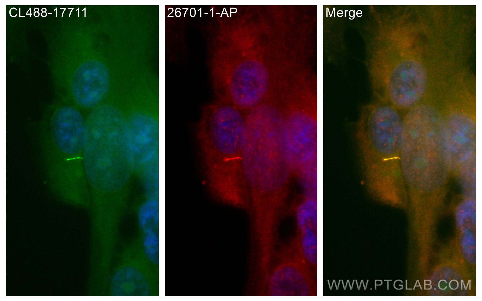 Immunofluorescence (IF) / fluorescent staining of hTERT-RPE1 cells using WDR35 Polyclonal antibody (26701-1-AP)